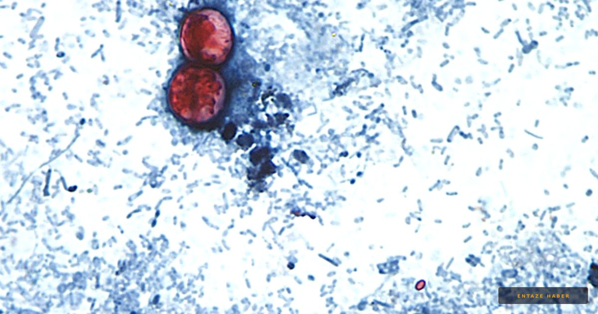 Summer Parasite Alert: How to Safely Enjoy Fresh Produce Amidst Cyclospora Outbreaks