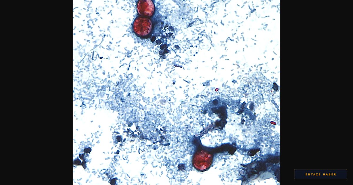 Record-Breaking Cyclospora Outbreak Surpasses 1,000 Cases: Urgent Health Alert